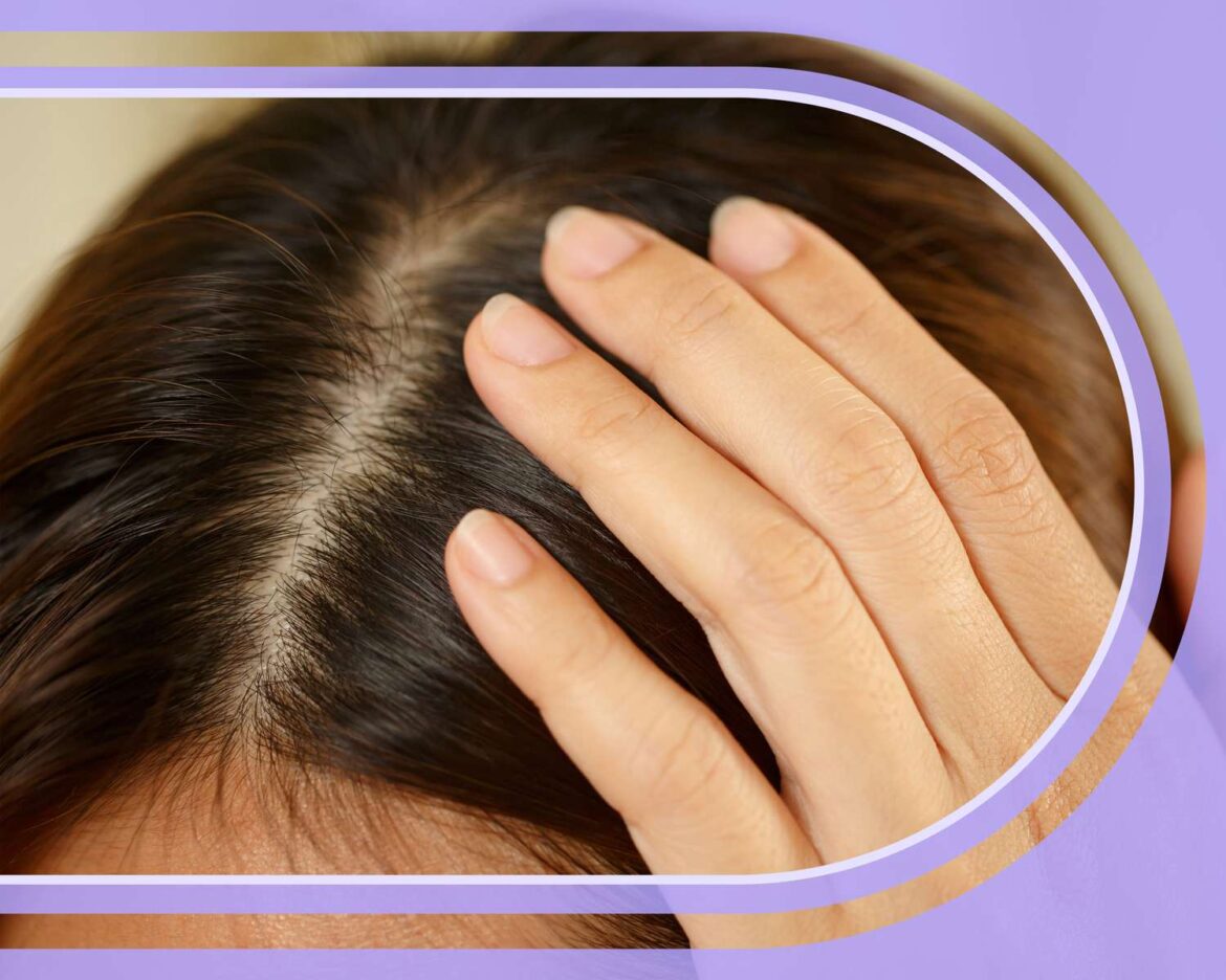 Do You Need SPF for Your Scalp? Here's Everything You Should Know