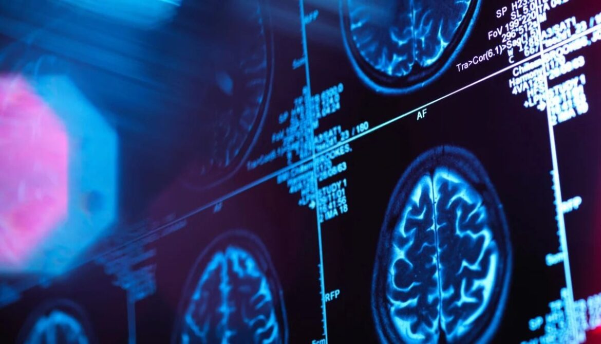 New study maps five brain ‘eras’ showing adulthood not starting until early 30s