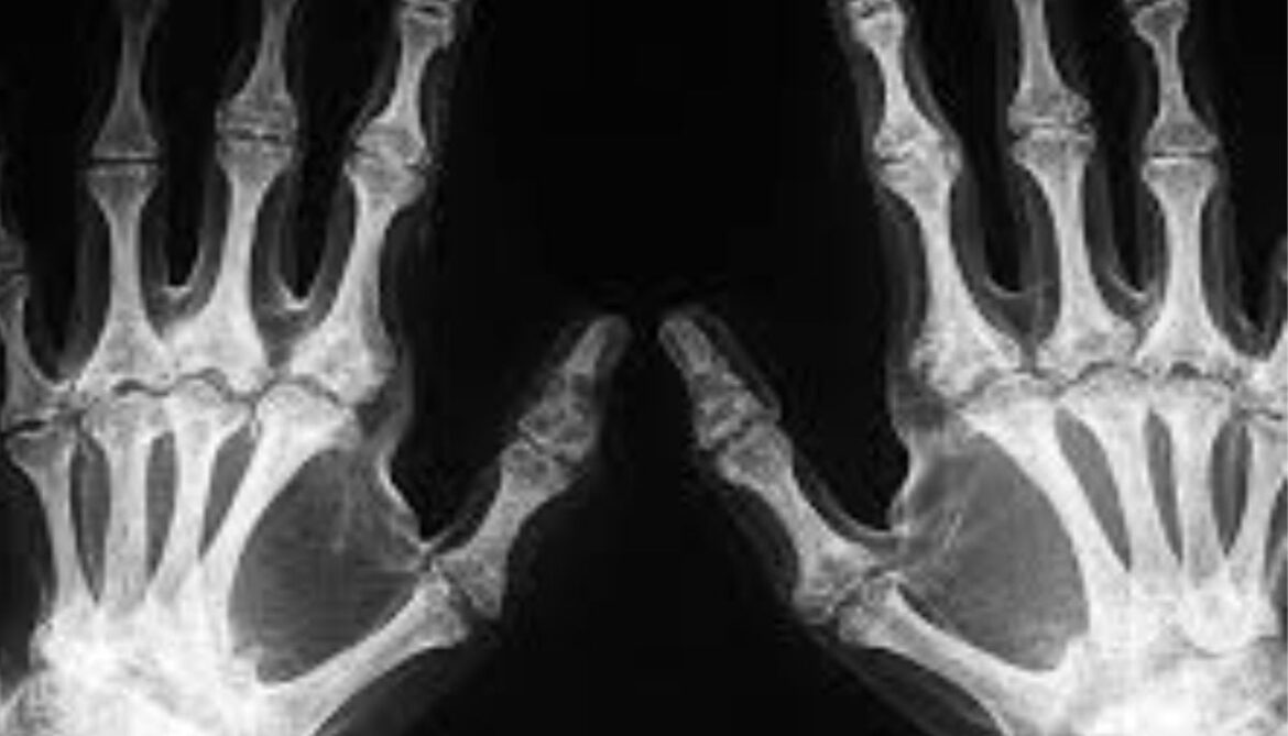 Scientists uncover the ‘acquired habit’ behind the human handedness puzzle